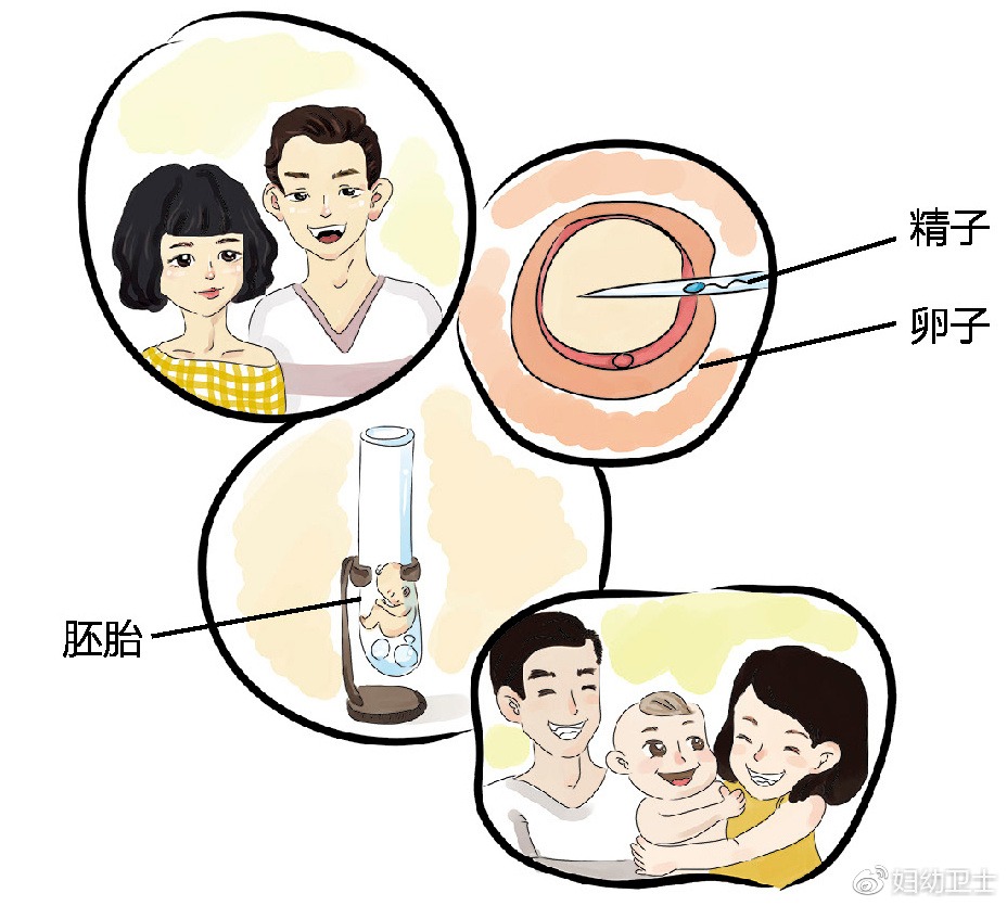 孕妇做亲子鉴定