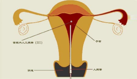 云南代生宝宝价格多少