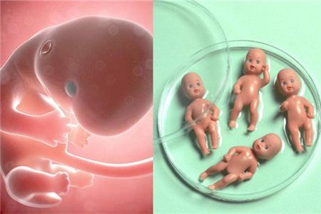 乌克兰试管助孕