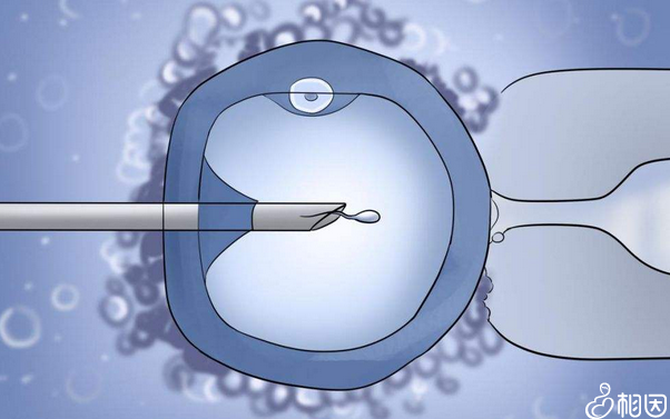 乌鲁木齐三代试管选性别